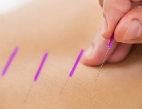 Acupuncture for a Healthier Heart